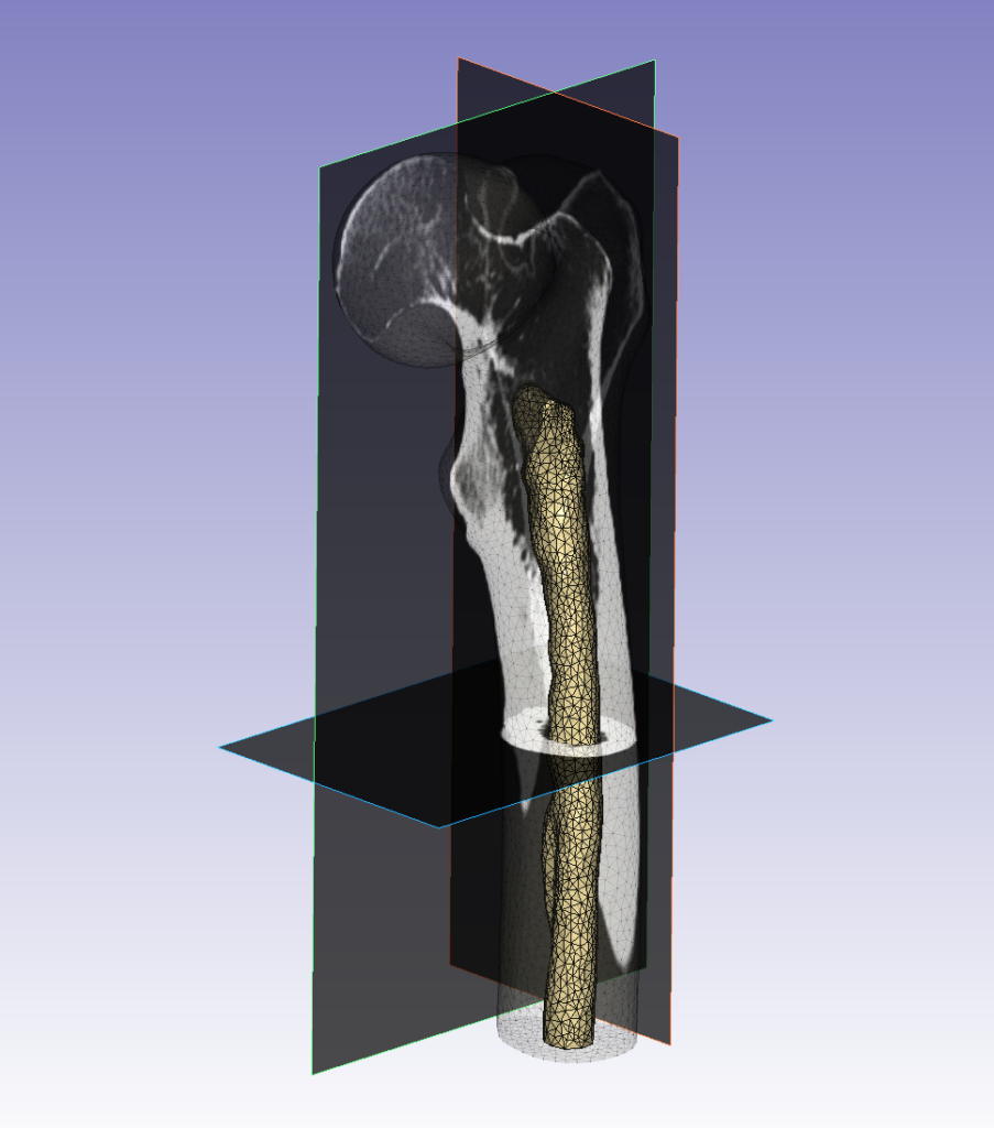 Ansys simpleware